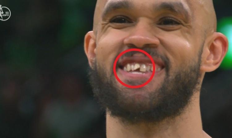 小白回忆总决赛门牙受伤：随后命中关键三分成最美时刻